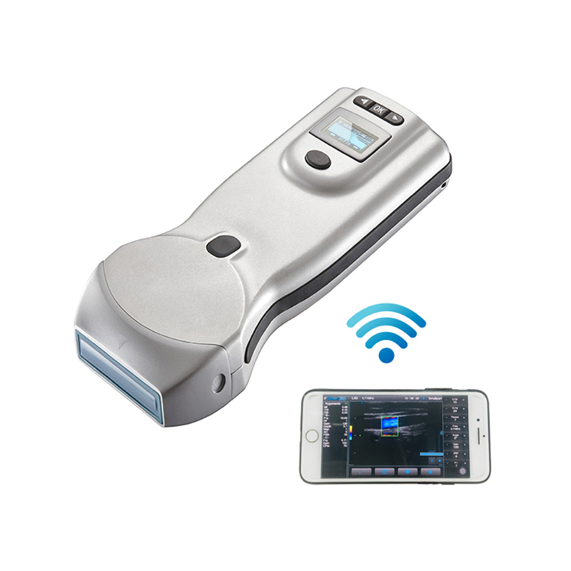 Ultrasuoni di Doppler di colore mobile e portatile dell'ospedale
